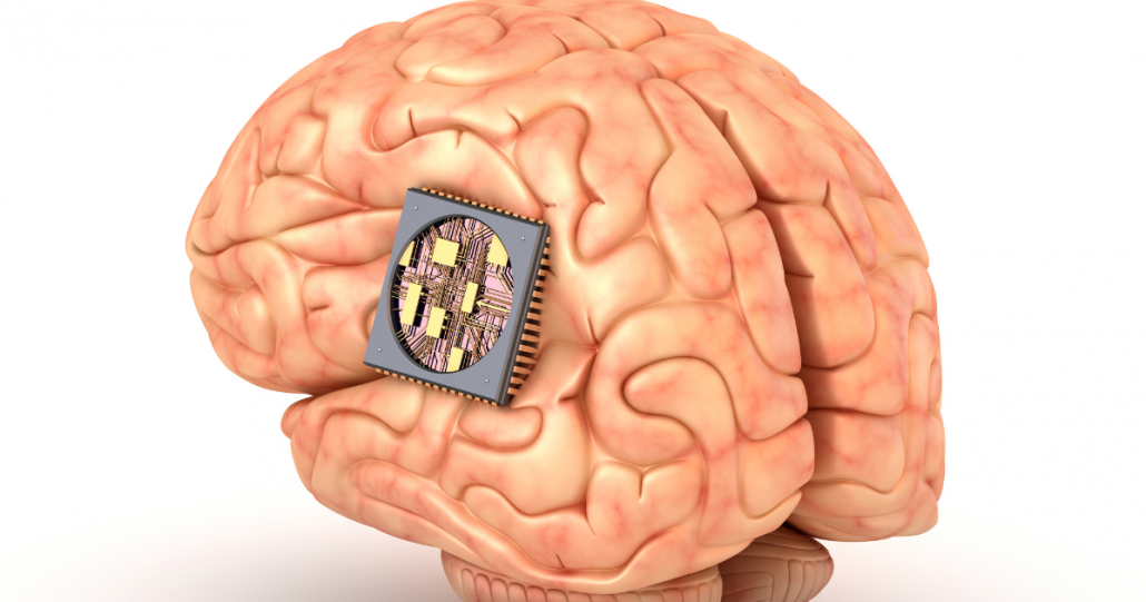 Neuralink procura voluntários para testar chip cerebral