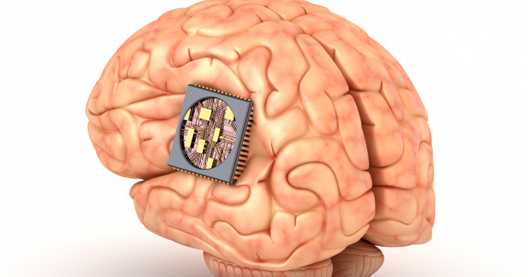 Neuralink faz 1º implante de chip cerebral em humano